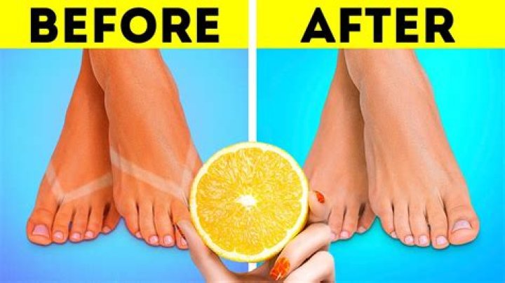 How To Get Skinnier Feet